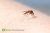 Alergia na ukąszenia komarów